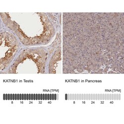 katanin-p80 Antibody, Novus Biologicals 0.1mL; Unlabeled:Antibodies, Polyclonal
