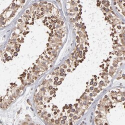 kinectin Antibody, Novus Biologicals 0.1mL; Unlabeled:Antibodies, Polyclonal