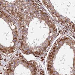 midA Antibody, Novus Biologicals 0.1mL; Unlabeled:Antibodies, Polyclonal