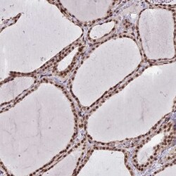 mpp8 Antibody, Novus Biologicals 25 &mu;L, Unconjugated:Anticuerpos