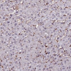 mpp8 Antibody, Novus Biologicals 25 &mu;L, Unconjugated:Antibodies, Polyclonal