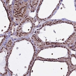 mpp8 Antibody, Novus Biologicals 25 &mu;L, Unconjugated:Antibodies, Polyclonal