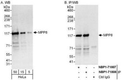 mpp8 Antibody, Novus Biologicals 0.1mg; Unlabeled:Antibodies, Polyclonal