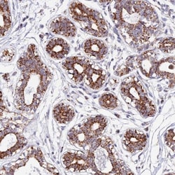 mtTFA Antibody, Novus Biologicals 0.1mL; Unlabeled:Antibodies, Polyclonal