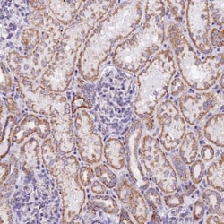 mtTFA Antibody, Novus Biologicals 0.1mL; Unlabeled:Antibodies, Polyclonal