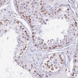 mtTFA Antibody, Novus Biologicals 0.1mL; Unlabeled:Antibodies, Polyclonal