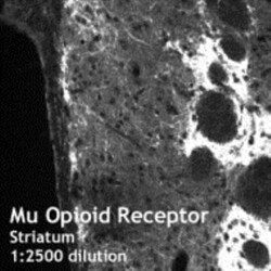 mu Opioid R/OPRM1 Antibody 0.05mL; Unlabeled:Antibodies, Polyclonal