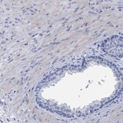 myozenin 3 Antibody, Novus Biologicals:Antibodies:Primary Antibodies
