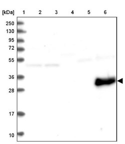 myozenin 3 Antibody, Novus Biologicals:Antibodies:Primary Antibodies