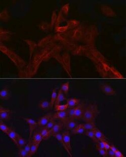 nNOS Rabbit anti-Human, Mouse, Rat, Clone: 5K9R2, Novus Biologicals 100 &mu;g | Buy Online | Novus Biologicals | Fisher Scientific