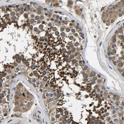 nSMase Antibody, Novus Biologicals 0.1mL; Unlabeled:Antibodies, Polyclonal