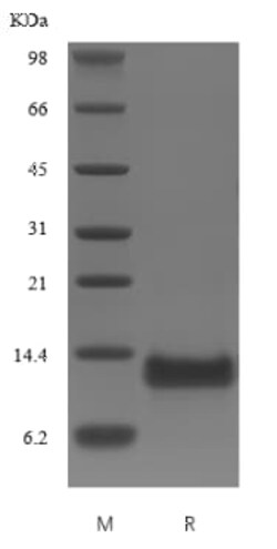Novus Biologicals Recombinant Human BAFFR/TNFRSF13C Protein 10 &mu;g | Buy Online | Novus Biologicals&trade; | Fisher Scientific