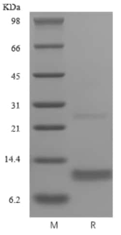 Novus Biologicals Recombinant Human CCL4/MIP-1 beta Protein 1 mg | Buy Online | Novus Biologicals&trade; | Fisher Scientific