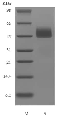 Novus Biologicals Recombinant Human Serpin I1/Neuroserpin Protein 5 &mu;g | Buy Online | Novus Biologicals&trade; | Fisher Scientific