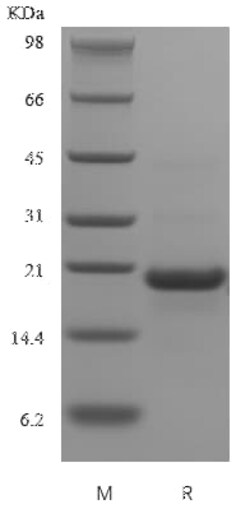 Novus Biologicals Recombinant Human CD23/Fc epsilon RII Protein 1 mg:Proteínas