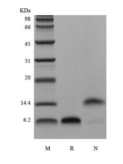 Novus Biologicals Recombinant Human EGF Protein 500 &mu;g | Buy Online | Novus Biologicals&trade; | Fisher Scientific