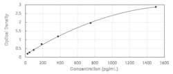 Novus Biologicals&trade;&nbsp;Human Lipoprotein Lipase/LPL - Ready-To-Use ELISA Kit (Colorimetric)