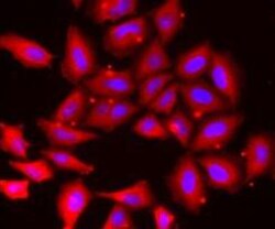 Tropomodulin 4 Antibody - BSA Free, Novus Biologicals 100 &mu;g | Buy Online | Novus Biologicals | Fisher Scientific