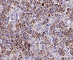 Tropomodulin 4 Antibody - BSA Free, Novus Biologicals 100 &mu;g | Buy Online | Novus Biologicals | Fisher Scientific