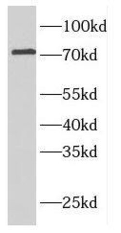 ELL2 Antibody - BSA Free, Novus Biologicals 100 &mu;g | Buy Online | Novus Biologicals | Fisher Scientific