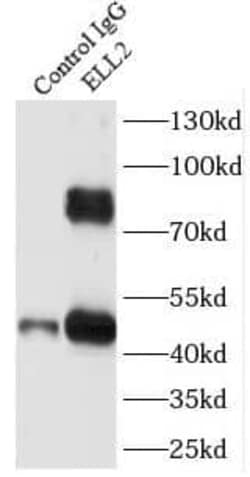 ELL2 Antibody - BSA Free, Novus Biologicals 100 &mu;g | Buy Online | Novus Biologicals | Fisher Scientific
