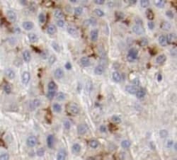 TMEM181 Antibody - BSA Free, Novus Biologicals 100 &mu;g | Buy Online | Novus Biologicals | Fisher Scientific