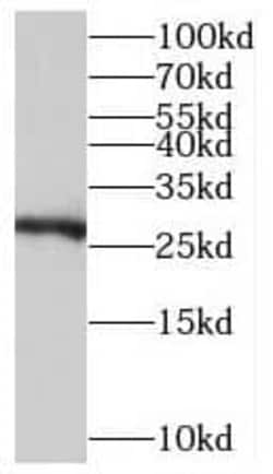 TMEM176A Antibody - BSA Free, Novus Biologicals 100 &mu;g | Buy Online | Novus Biologicals | Fisher Scientific