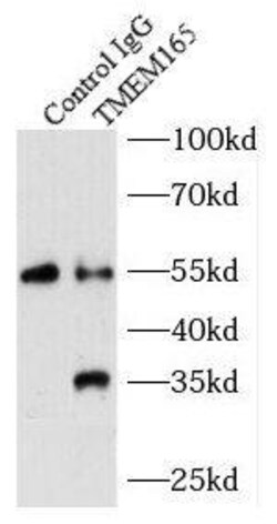 TMEM165 Antibody - BSA Free, Novus Biologicals 100 &mu;g | Buy Online | Novus Biologicals | Fisher Scientific