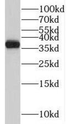 TMEM165 Antibody - BSA Free, Novus Biologicals 100 &mu;g | Buy Online | Novus Biologicals | Fisher Scientific