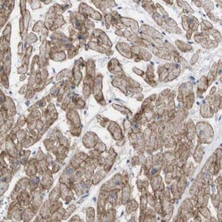 TMEM127 Antibody - BSA Free, Novus Biologicals 100 &mu;g | Buy Online | Novus Biologicals | Fisher Scientific