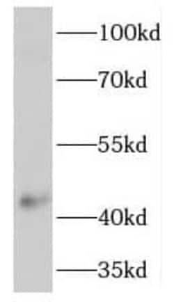 TMEM120A Antibody - BSA Free, Novus Biologicals 100 &mu;g | Buy Online | Novus Biologicals | Fisher Scientific