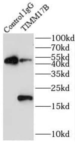 TIMM17B Antibody - BSA Free, Novus Biologicals 100 &mu;g | Buy Online | Novus Biologicals | Fisher Scientific