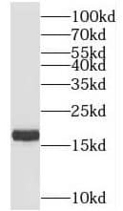 TIMM17B Antibody - BSA Free, Novus Biologicals 100 &mu;g | Buy Online | Novus Biologicals | Fisher Scientific