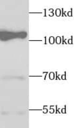 Elongin A Antibody - BSA Free, Novus Biologicals 100 &mu;g | Buy Online | Novus Biologicals | Fisher Scientific