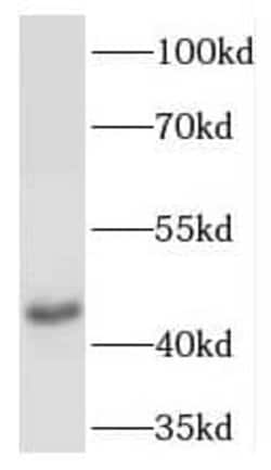 NK2R Antibody - BSA Free, Novus Biologicals 100 &mu;g | Buy Online | Novus Biologicals | Fisher Scientific