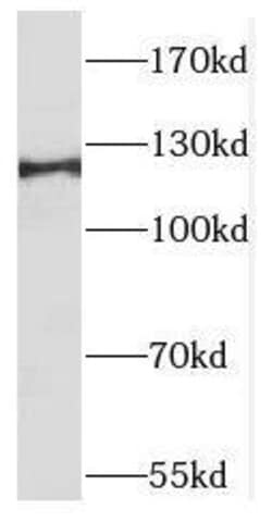 TACC1 Antibody - BSA Free, Novus Biologicals 100 &mu;g | Buy Online | Novus Biologicals | Fisher Scientific