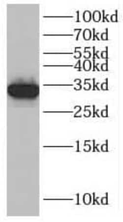 SLC25A34 Antibody - BSA Free, Novus Biologicals 100 &mu;g | Buy Online | Novus Biologicals | Fisher Scientific