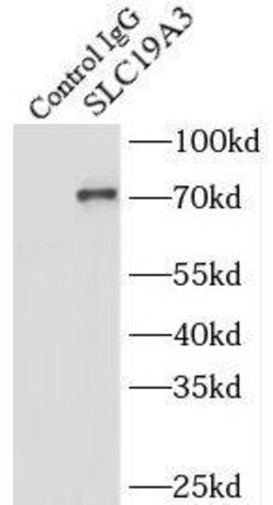 SLC19A3 Antibody - BSA Free, Novus Biologicals 100 &mu;g | Buy Online | Novus Biologicals | Fisher Scientific
