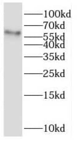 MCT8/SLC16A2 Antibody - BSA Free, Novus Biologicals 100 &mu;g | Buy Online | Novus Biologicals | Fisher Scientific