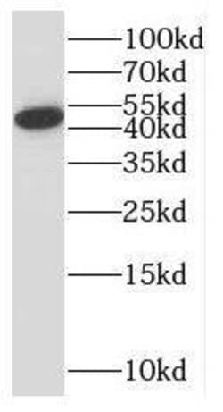 SLC10A3 Antibody - BSA Free, Novus Biologicals 100 &mu;g | Buy Online | Novus Biologicals | Fisher Scientific