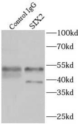 SIX2 Antibody - BSA Free, Novus Biologicals 100 &mu;g | Buy Online | Novus Biologicals | Fisher Scientific