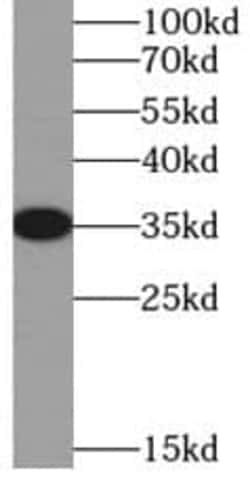 SIX2 Antibody - BSA Free, Novus Biologicals 100 &mu;g | Buy Online | Novus Biologicals | Fisher Scientific