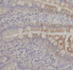 SIDT1 Antibody - BSA Free, Novus Biologicals 100 &mu;g | Buy Online | Novus Biologicals | Fisher Scientific