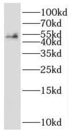 SHF Antibody - BSA Free, Novus Biologicals 100 &mu;g | Buy Online | Novus Biologicals | Fisher Scientific