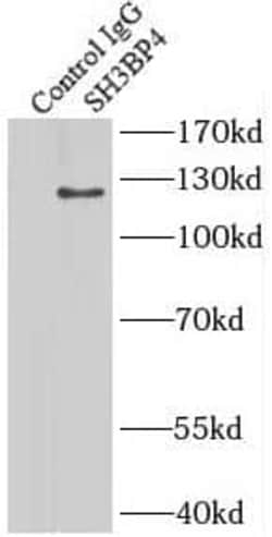SH3BP4 Antibody - BSA Free, Novus Biologicals 100 &mu;g | Buy Online | Novus Biologicals | Fisher Scientific