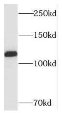SH3BP4 Antibody - BSA Free, Novus Biologicals 100 &mu;g | Buy Online | Novus Biologicals | Fisher Scientific
