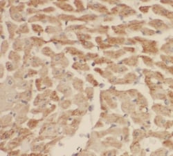 SH3BGR Antibody - BSA Free, Novus Biologicals 100 &mu;g | Buy Online | Novus Biologicals | Fisher Scientific