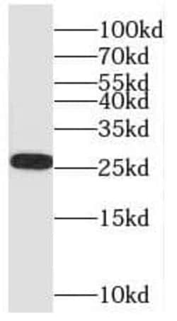 SH3BGR Antibody - BSA Free, Novus Biologicals 100 &mu;g | Buy Online | Novus Biologicals | Fisher Scientific