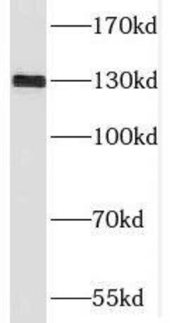 SGSM1 Antibody - BSA Free, Novus Biologicals 100 &mu;g | Buy Online | Novus Biologicals | Fisher Scientific