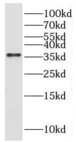 gamma Sarcoglycan Antibody - BSA Free, Novus Biologicals 100 &mu;g | Buy Online | Novus Biologicals | Fisher Scientific